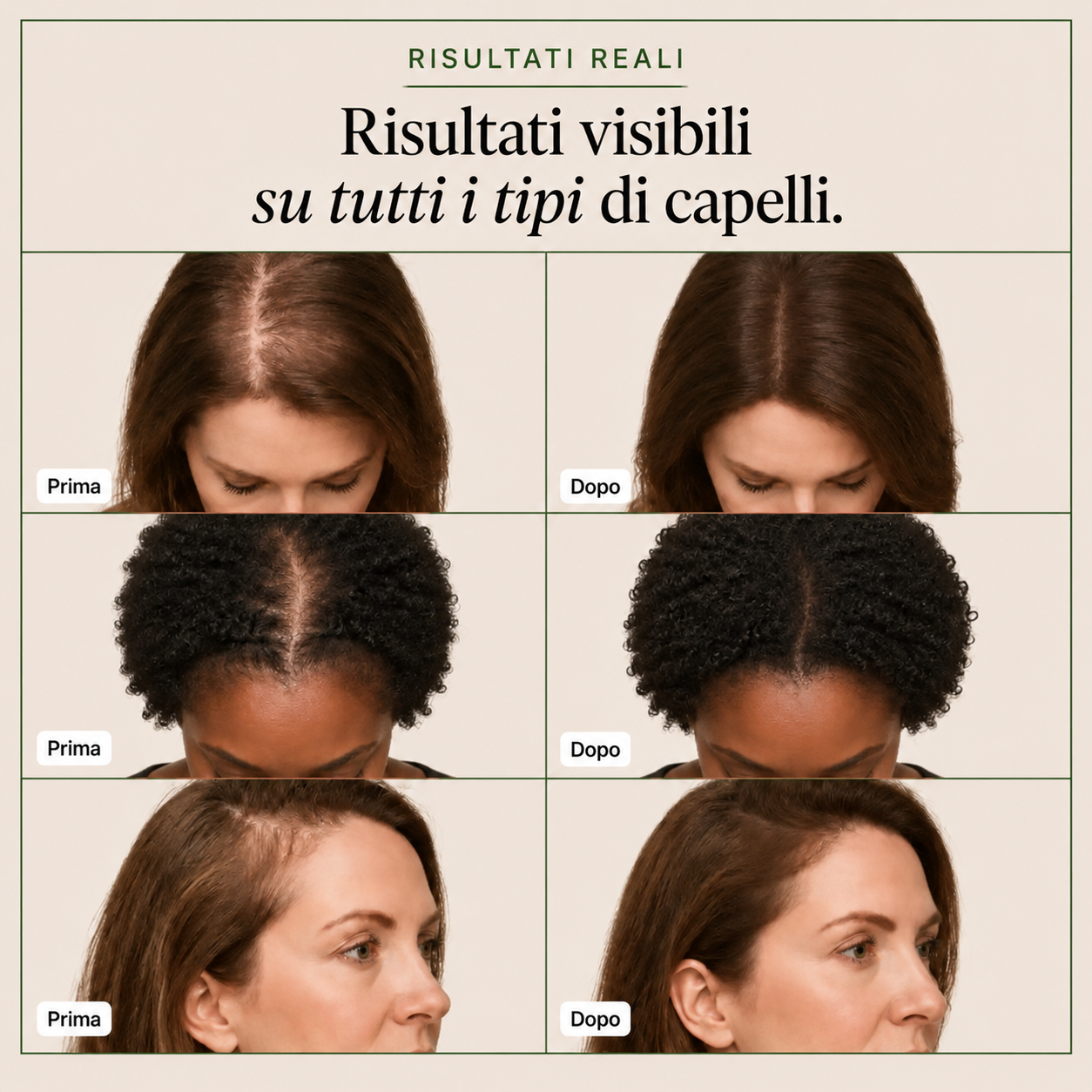 Siero per capelli Ariva